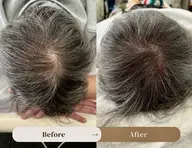 つむじのお悩み解消ヘアアート（SMP）