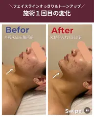 【初回限定】肩まわりガチガチ！すっきり首肩・小顔ケア体験！