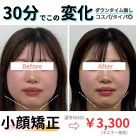 【🌟minimo限定🌟】小顔矯正6600→4400