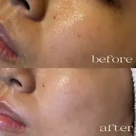 🌹フェイシャルWaxxxx🌹