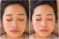 平日限定🙌🏻小顔矯正コルギ＋上半身ほぐし付🉐韓国アイドル顔🇰🇷《残り枠数わずか！！》