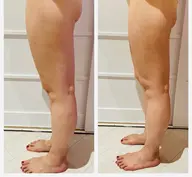 脚むくみ、背中やお腹たるみ、⭐︎小顔コルギと全身コルギ.痩身マシンコース