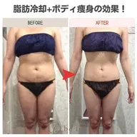 迷った方はコレ👍オーダーメイド痩身💖♪あなたにあわせた痩身プランでしっかり結果を出します😁☆平日限定3980円