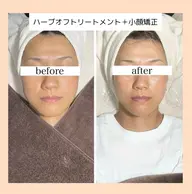 贅沢🌿‬ハーブオフトリートメント＋矯正美顔マッサージ