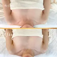 【☆オープン記念価格☆】京都府初導入NR機器使用!!1回で結果出し！☆ＮRベルバスト☆39.800円→5.980円