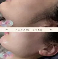 【ミニモ限定初回¥4500円】毛穴レス/つるすべフェイスWAX