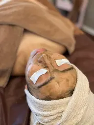 話題のヒト幹細胞ハーブ🌿リフトアップしたい方はこちら⭐️シワしみ改善も！剥離ある可能性有り☘️まずはお試ししたい方2g