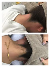 お肌に優しい高品質wax使用💓✨女性Face うなじwax➕保湿仕上げ(鎮静パック付き)