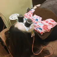 【ライト】美容鍼