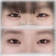 ラッシュリフト(上のみ)🫧