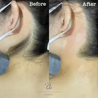 [女性]ワックス　VIO・うなじ・背中セット