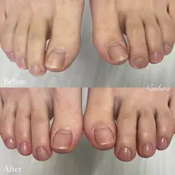 【フット】こだわりケア