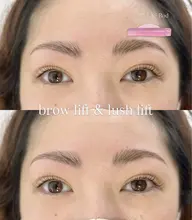 アイブロウリフト