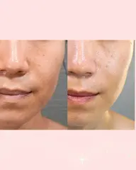 【お悩み：むくみ】小顔スッキリ♪リフトアップフェイシャル　60分（初回カウンセリング・着替え込み120分）