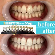 【定額制/通い放題パックをご希望の方】¥5,500​〜​