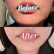 デコルテ＆フェイシャルマッサージ＆肌質別パック🧡