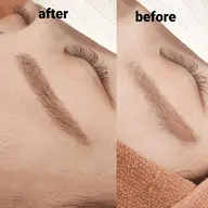 💚美眉デザイン◎低刺激シート脱毛で理想の眉毛