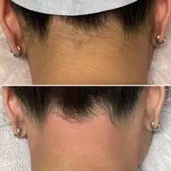 えりあし＋うなじ