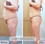 【全身痩身ダイエット♪】4Dシェイプ+ハイパーナイフ+全身リンパ《90分》