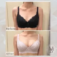 《4月限定》美バスト×美くびれ🫶 バストケアトリートメント[90分]＋腸もみ[15分]  《お写真提供OKの方》