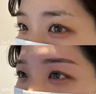 ハリウッドブロウリフト