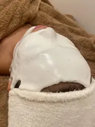 🤍日焼け後のケア、ニキビ跡、シミにおススメパック🤍『アドバンスコース+ブライトニングパック』