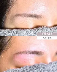 【男女OK】【期間限定▶︎特価!眉毛脱毛(眉まわり脱毛)✨