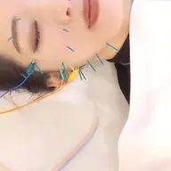 【小顔に特化❣️】もったり顔スッキリ!!小顔美容鍼灸(美容鍼灸+美顔美頭マッサージ)カウンセリング込