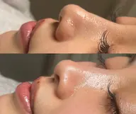 フェイスワックスお試し🫧部分(おでこ、口周り、眉毛周り、フェイスライン)のパーツ🖐️2箇所から選べる