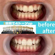 【都度払い】汚れ黄ばみをしっかり落とす