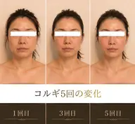 【速攻×持続】本格コルギ＋肩甲骨剥がし＋小顔定着！石膏パック付｜カウンセリングお会計込みで90分