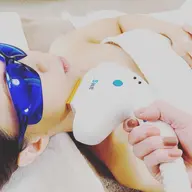 初回レディース顔脱毛