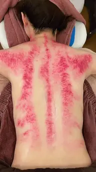 【かっさ* からだデトックス背中付】背中・頭・フェイス・デコルテ・首筋 ∥ 不眠✨落ち込み✨コリ✨むくみ✨慢性疲労✨