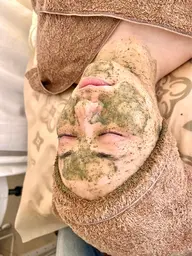 【Reviハーブピーリング🌿】ニキビ肌、敏感肌、艶々毛穴レスへ🥚✨むくみスッキリで小顔効果あり！