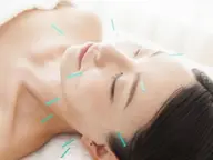 美容鍼スタンダード【美容鍼が初めての方にオススメ✨】