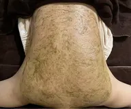 剥離ありノーマル･ハーブピーリング背中🌿薄皮程度の皮剥けありダウンタイム3​〜​5日間あり✨