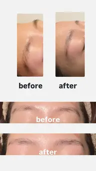 眉・おでこワックス（軽く形も整えます）