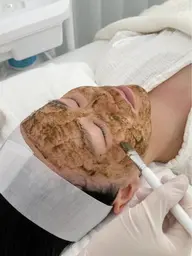 毛穴レス/ニキビケアに♪ ハーブピーリング ¥12,800→¥9,980