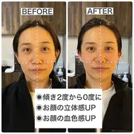 【メンテナンス】骨格補正ヘッドスパ＋Xトリートメント