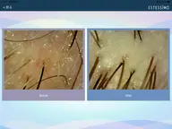 【1日1名様限定】ヘッドスパ施術のSNS用動画撮影モデル募集中！