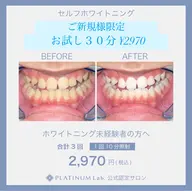 ご新規様限定🦷セルフホワイトニングお試し30分✨自然な清潔感ある白さを目指していきます💎メンズも大歓迎✨ ☝️