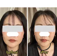 不調なところを全身調整!骨盤矯正✖️整形級小顔ヘッドスパ!肩こり頭痛も解消!