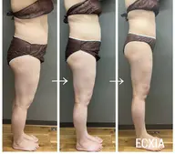 【最強痩身☆】ベーシックオールハンド痩身エステ！全身にアプローチ！人気メニュー♪1番人気メニュー⭐︎