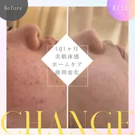 すっぴんに自信、取り戻そう🪞💓 🎐透明感UPモニター募集中！