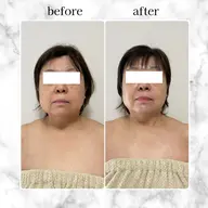 🌿小顔矯正コルギ練習モデル価格🌿