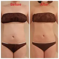 くびれ集中！浮き輪肉へアプローチ！話題の痩身マシーンでお腹&腰を徹底ケア☆