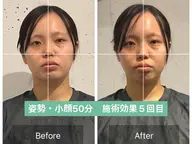 顔の歪み+小顔整体、骨盤調整【50分15900円→3500円】