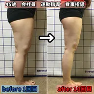 【太もも痩せ】ラジオ波&キャビ 短時間お得 所要30分