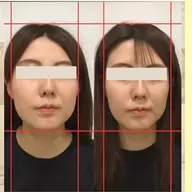 【整った輪郭へ】小顔3D整顔&肩こり・首こりケア カウンセリング含む全体50分