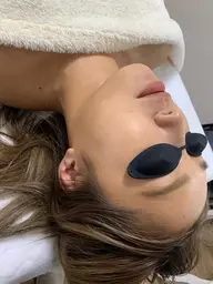 BBL フェイシャル